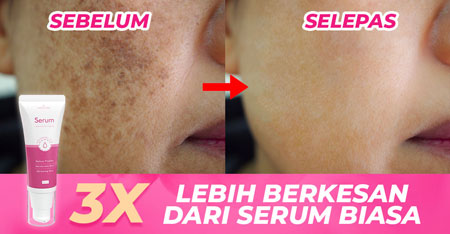 before-after-honeyglow-serum-01