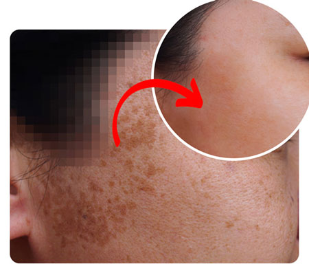 before-after-honeyglow-serum