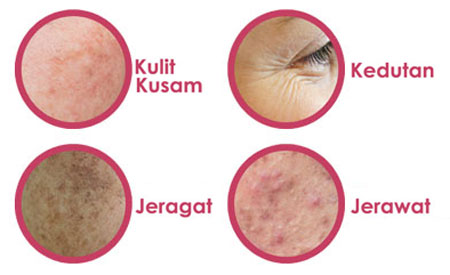 jeragat-jerawat-kulit-kusam-01