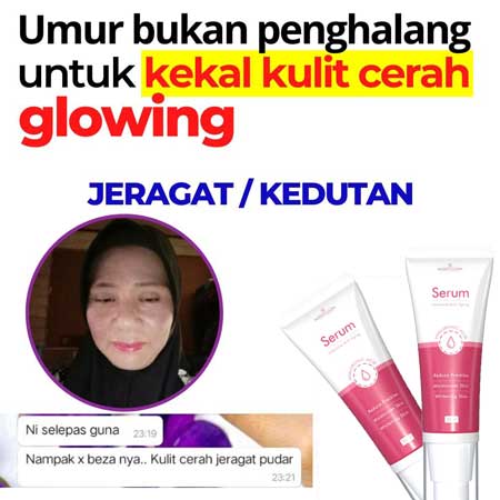 testimoni-honeyglow-serum-04