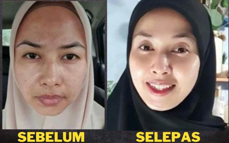 testimoni-honeyglow-serum-05